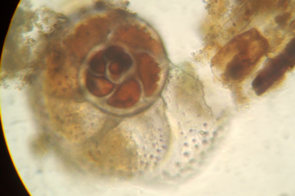 Foraminifera: verosimile Planorbulina variabilis